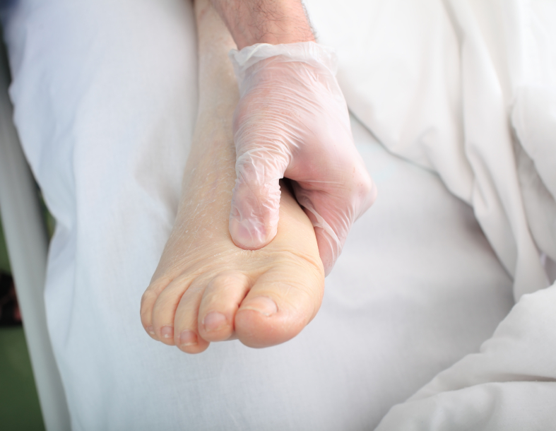 Flat Foot Problems And Its Causes